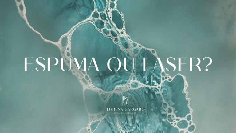Espuma ou laser: qual o melhor tratamento para varizes?