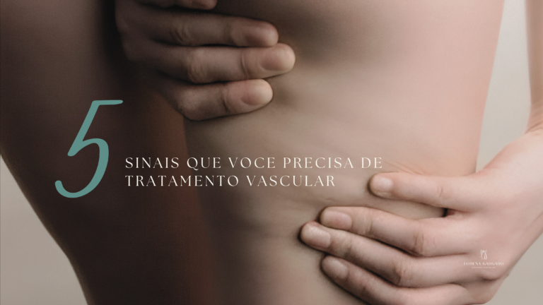 5 Sinais que você precisa de tratamento vascular!